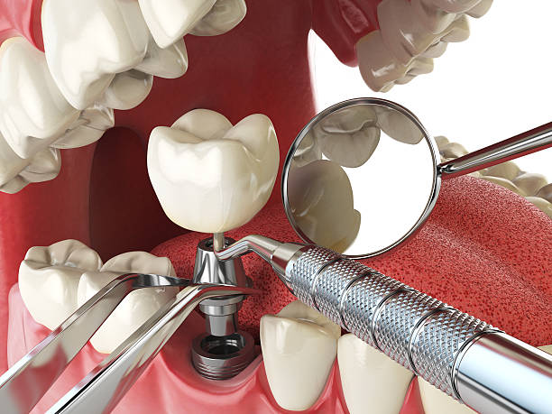 Best After-Hours Emergency Dentist in Old Jamestown, MO